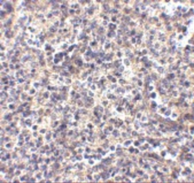 ATG5 Antibody in Immunohistochemistry (Paraffin) (IHC (P))