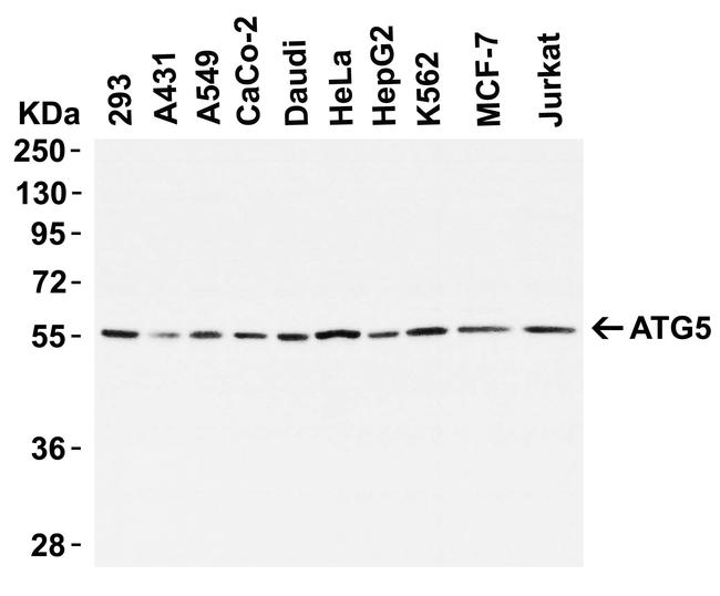 ATG5 Antibody in Western Blot (WB)