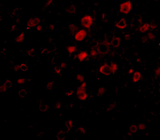 Bora Antibody in Immunocytochemistry (ICC/IF)