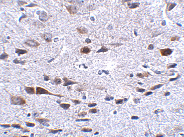 Bora Antibody in Immunohistochemistry (IHC)