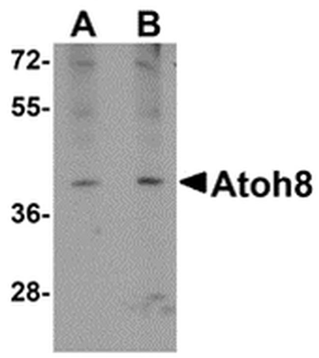 ATOH8 Antibody in Western Blot (WB)