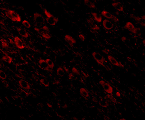 Amyloid Precursor Protein Antibody in Immunohistochemistry (IHC)