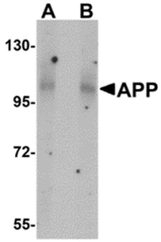 Amyloid Precursor Protein Antibody in Western Blot (WB)