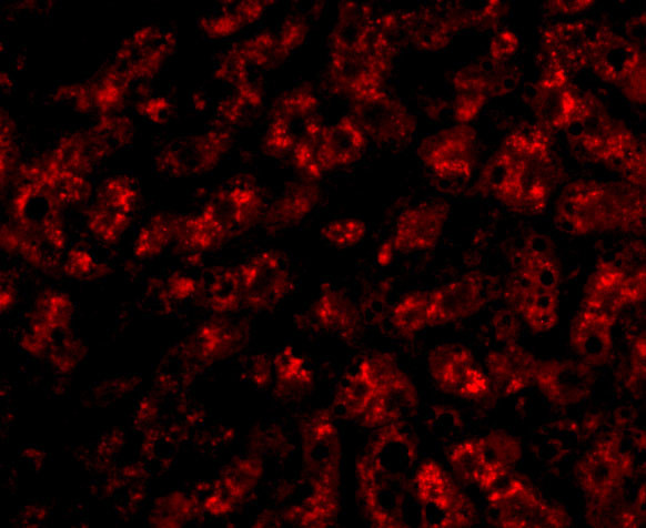 ApoA1 Antibody in Immunohistochemistry (IHC)