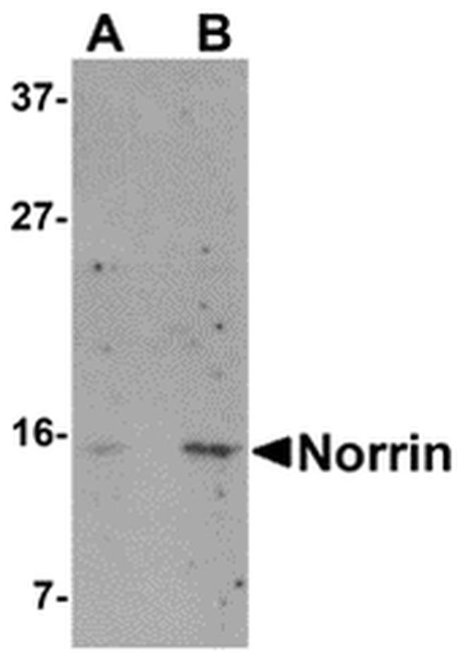 NDP Antibody in Western Blot (WB)