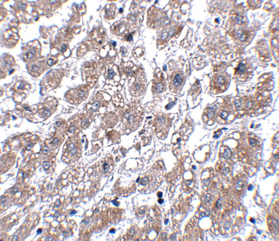 MATN1 Antibody in Immunohistochemistry (IHC)