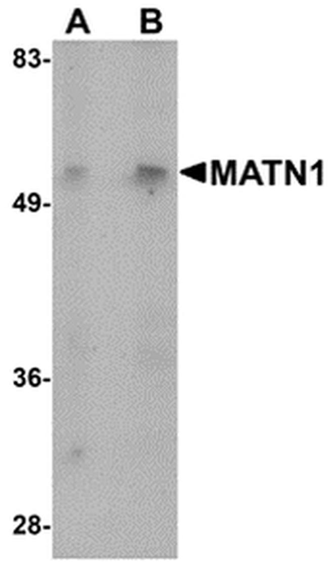 MATN1 Antibody in Western Blot (WB)