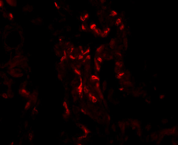 TNFAIP3 Antibody in Immunocytochemistry (ICC/IF)