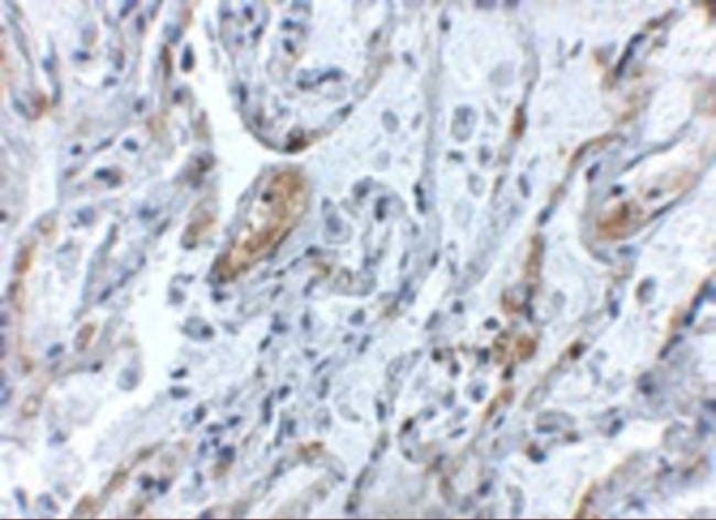 TNFAIP3 Antibody in Immunohistochemistry (IHC)