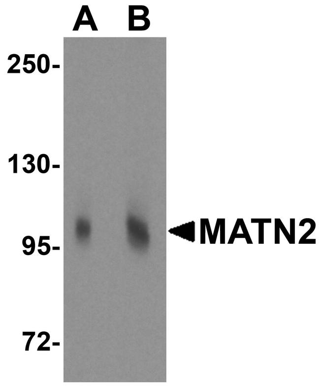 MATN2 Antibody in Western Blot (WB)