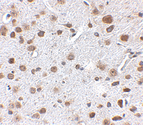 FTO Antibody in Immunohistochemistry (IHC)