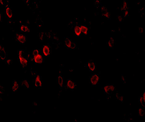 Amyloid Precursor Protein Antibody in Immunohistochemistry (IHC)