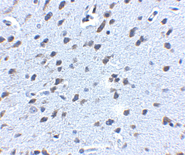 Amyloid Precursor Protein Antibody in Immunohistochemistry (IHC)