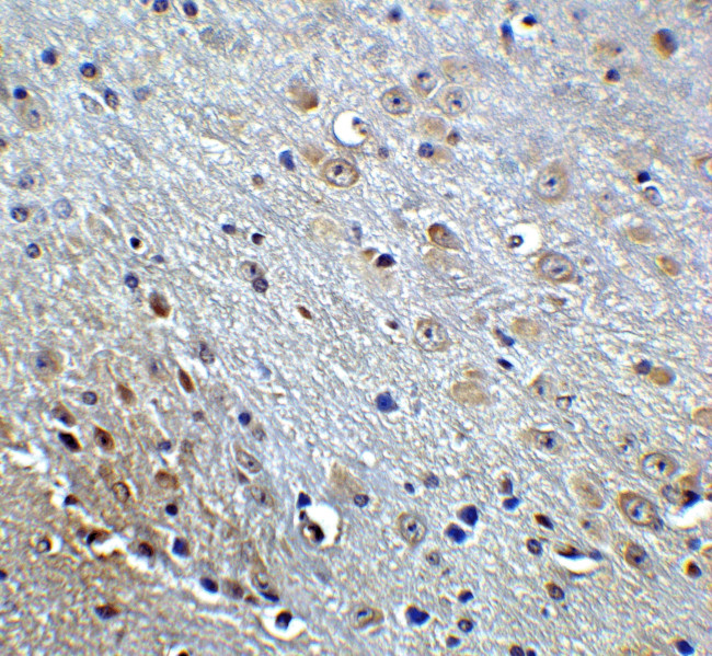 Amyloid Precursor Protein Antibody in Immunohistochemistry (IHC)