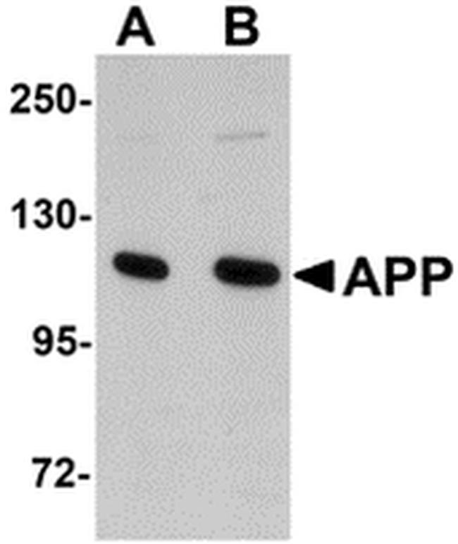 Amyloid Precursor Protein Antibody in Western Blot (WB)