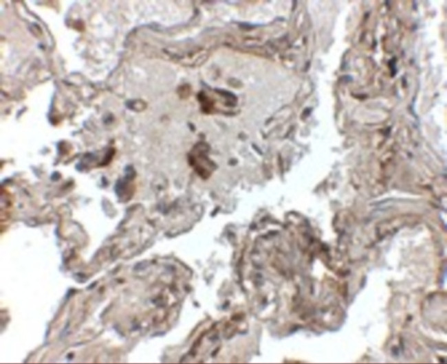 Transthyretin Antibody in Immunohistochemistry (IHC)