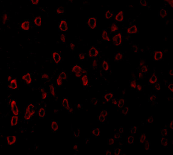 SCF Antibody in Immunohistochemistry (PFA fixed) (IHC (PFA))