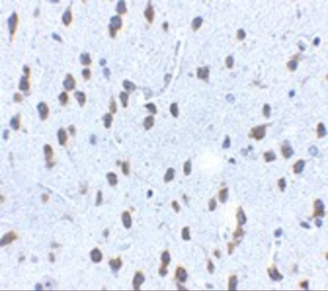 SCF Antibody in Immunohistochemistry (Paraffin) (IHC (P))