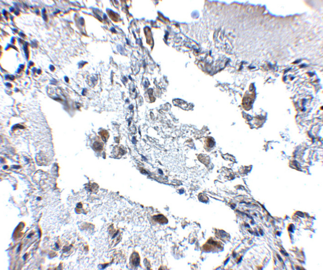 SH3BP4 Antibody in Immunohistochemistry (IHC)