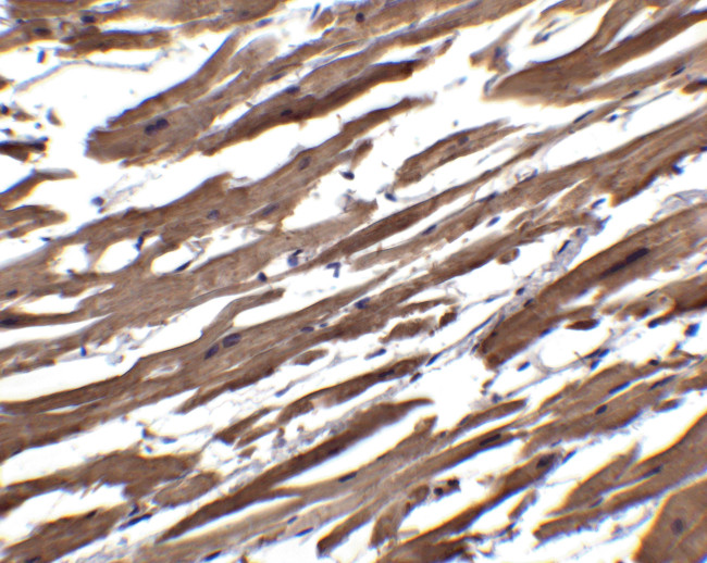 RSPO1 Antibody in Immunohistochemistry (Paraffin) (IHC (P))