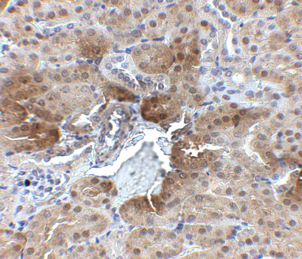 PTER Antibody in Immunohistochemistry (IHC)