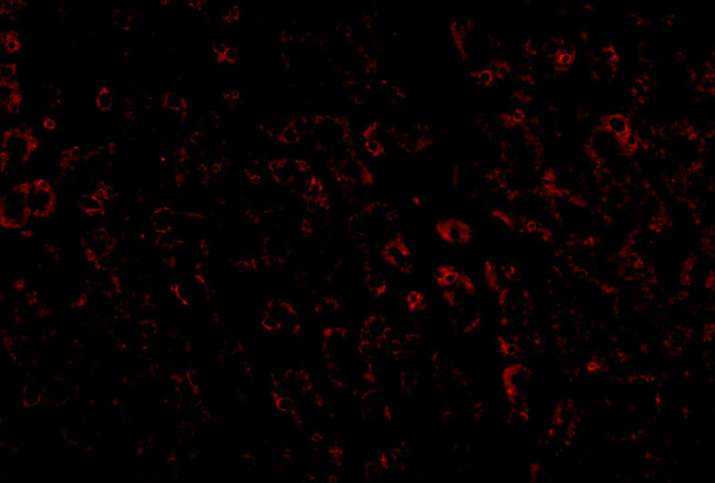 LDLR Antibody in Immunohistochemistry (IHC)