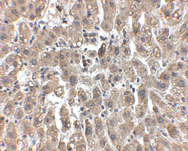 LDLR Antibody in Immunohistochemistry (IHC)