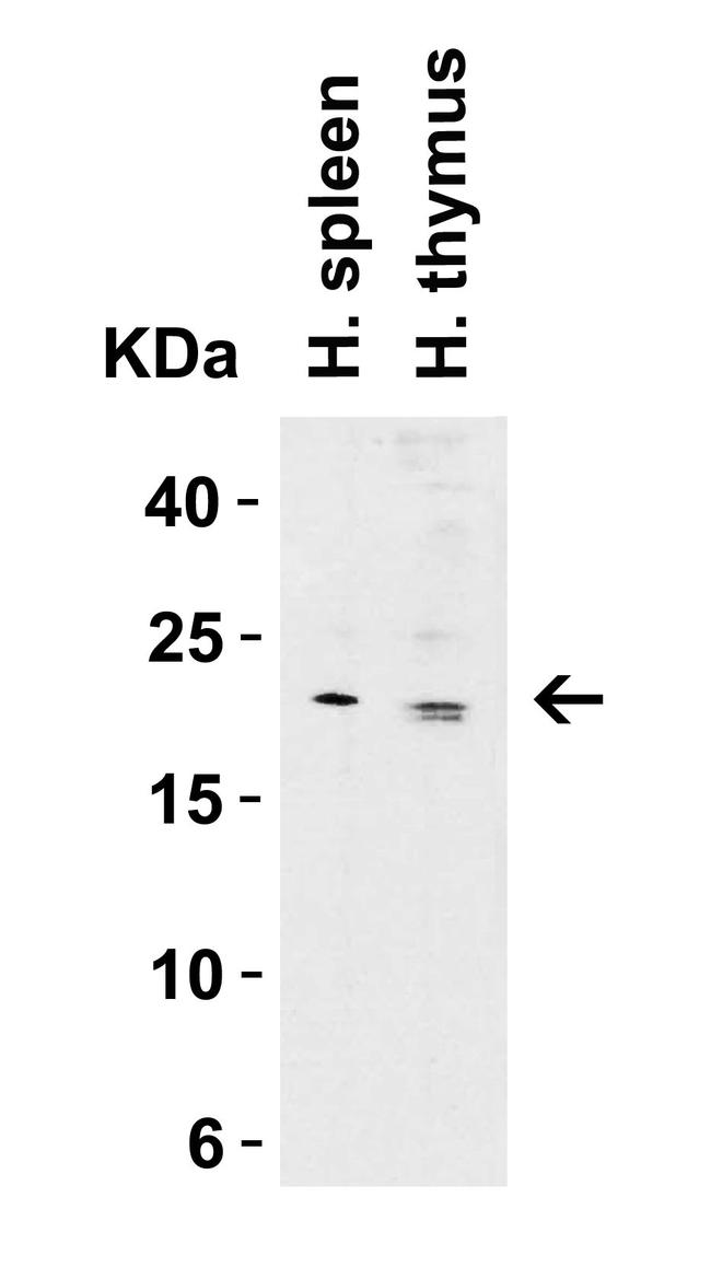 Claudin 1 Antibody in Western Blot (WB)