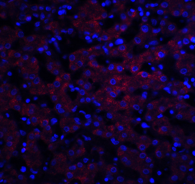 Occludin Antibody in Immunohistochemistry (IHC)