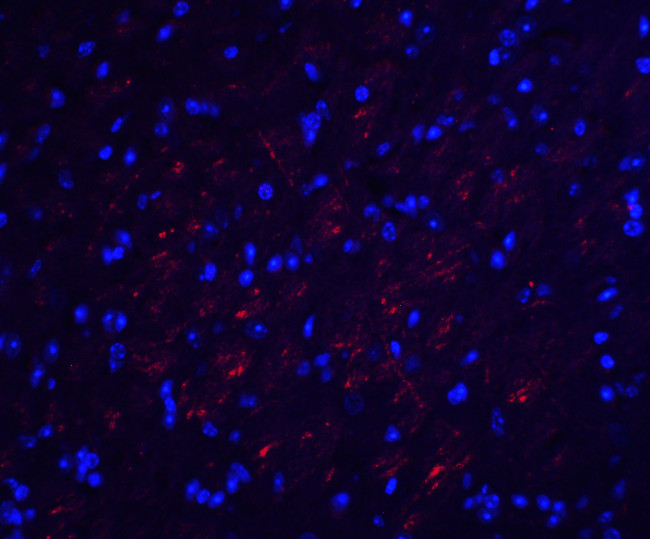 Occludin Antibody in Immunohistochemistry (IHC)