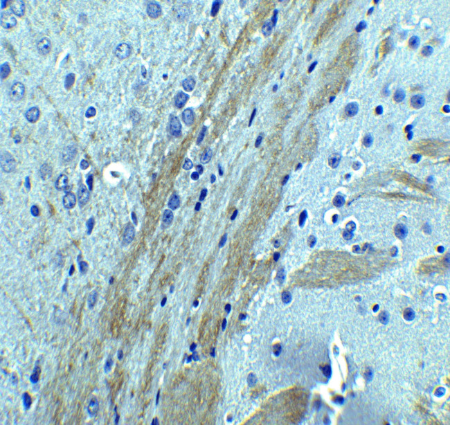 Occludin Antibody in Immunohistochemistry (IHC)