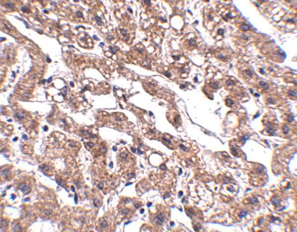 MACC1 Antibody in Immunohistochemistry (IHC)