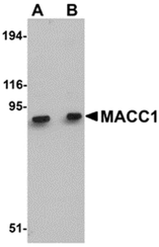 MACC1 Antibody in Western Blot (WB)