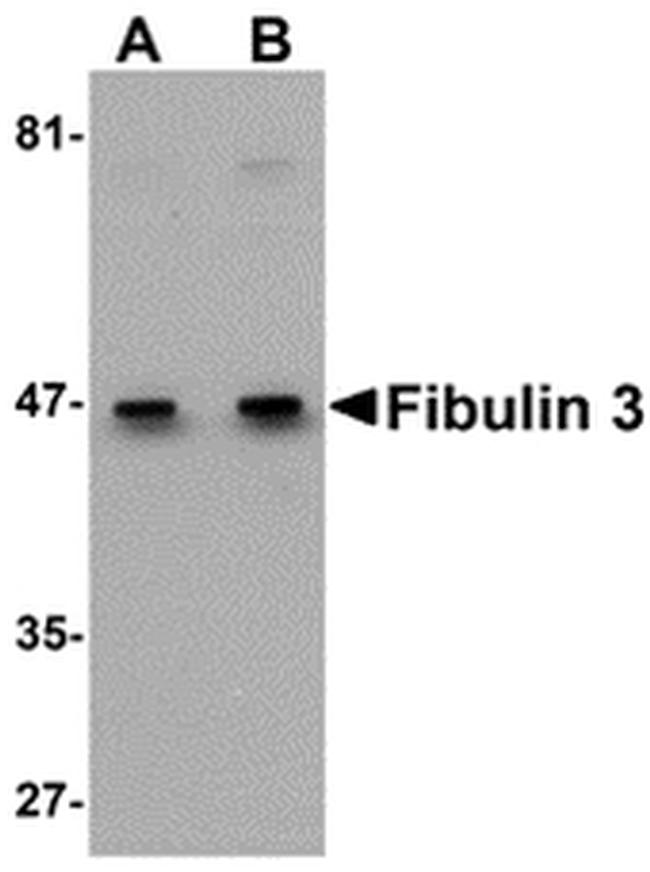 Fibulin 3 Antibody in Western Blot (WB)