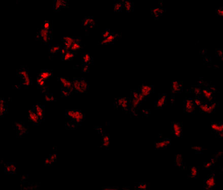 SCARA5 Antibody in Immunocytochemistry (ICC/IF)