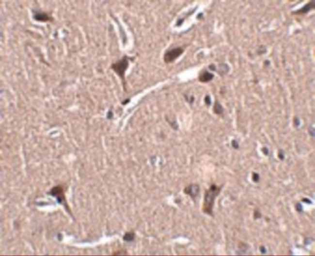 ZNF667 Antibody in Immunohistochemistry (IHC)