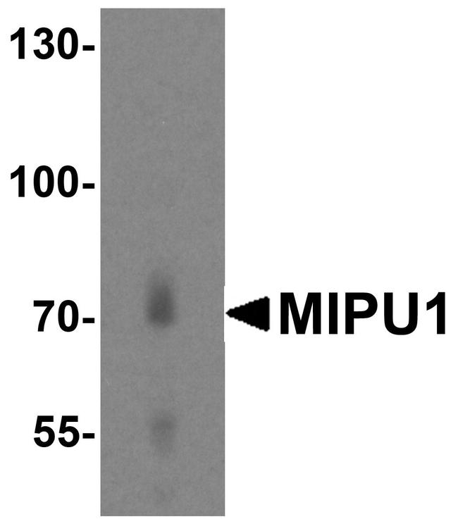 ZNF667 Antibody in Western Blot (WB)