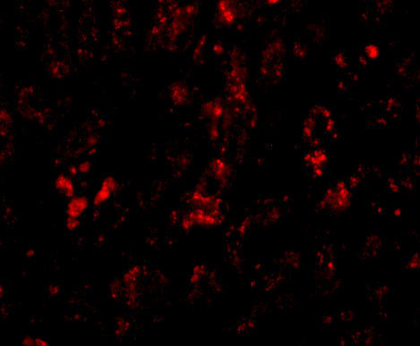 AFAP1L2 Antibody in Immunohistochemistry (IHC)