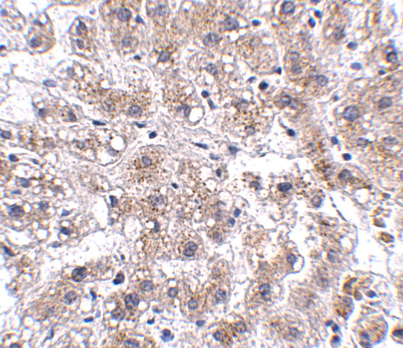 AFAP1L2 Antibody in Immunohistochemistry (IHC)