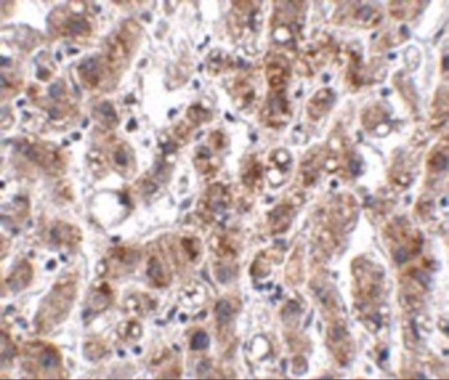 THEM2 Antibody in Immunohistochemistry (IHC)