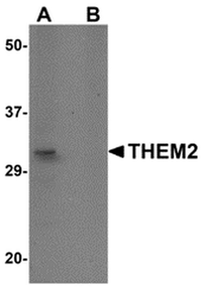 THEM2 Antibody in Western Blot (WB)