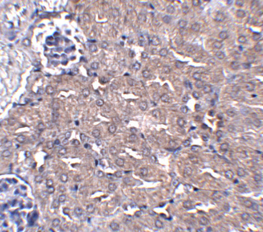 Ubiquilin 4 Antibody in Immunohistochemistry (IHC)