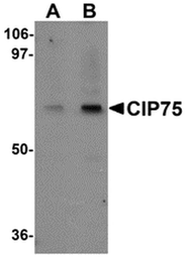 Ubiquilin 4 Antibody in Western Blot (WB)