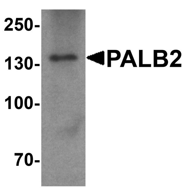 PALB2 Antibody in Western Blot (WB)