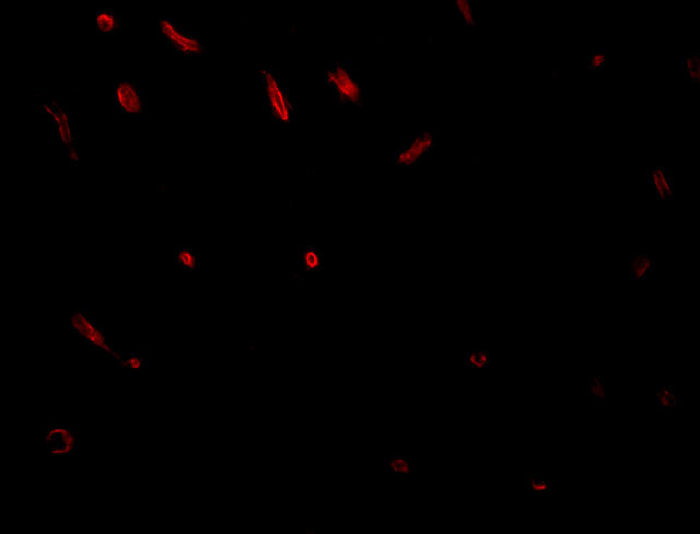 TWA1 Antibody in Immunohistochemistry (IHC)