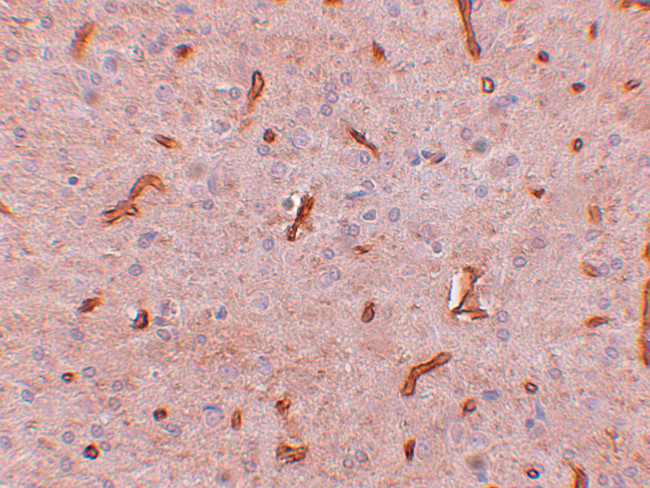 TWA1 Antibody in Immunohistochemistry (IHC)