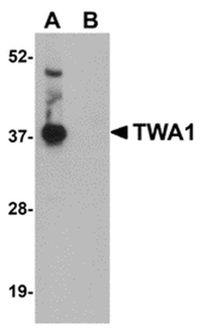 TWA1 Antibody in Western Blot (WB)