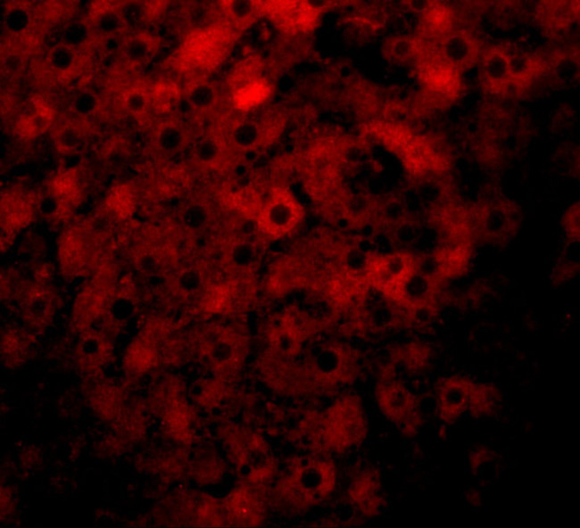 JMJD1B Antibody in Immunohistochemistry (IHC)