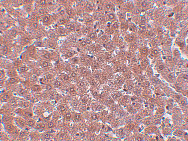 JMJD2A Antibody in Immunohistochemistry (IHC)