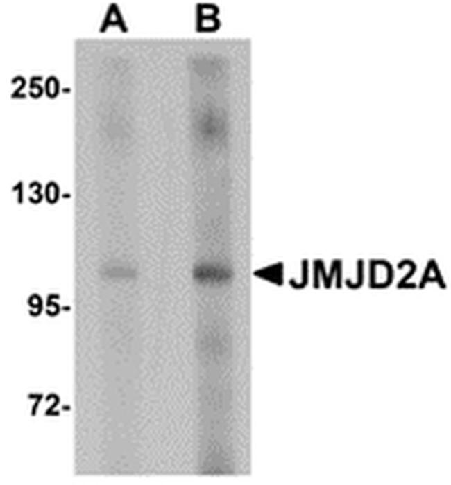 JMJD2A Antibody in Western Blot (WB)